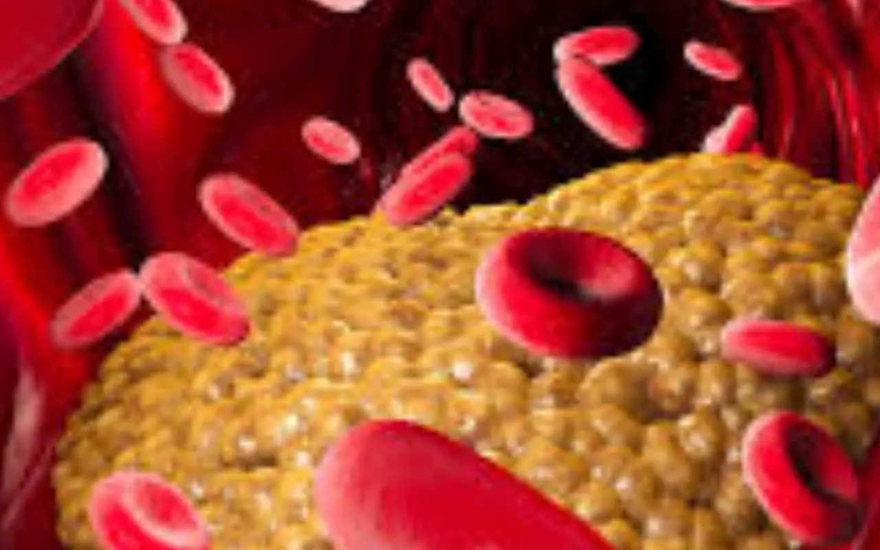 Sai davvero quali legumi abbassano il colesterolo? Scopri i più efficaci subito